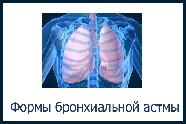 формы бронхиальной астмы