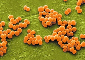 Золотистый стафилококк является достаточно устойчивой бактерией