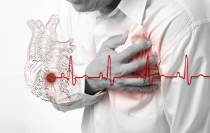 Кардиограмма сердца может помочь выявить признаки инфаркта миокарда