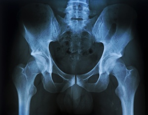 Рентгенография костей обязательно необходима для постановки диагноза
