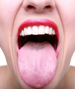 Налет на языке: как лечить?